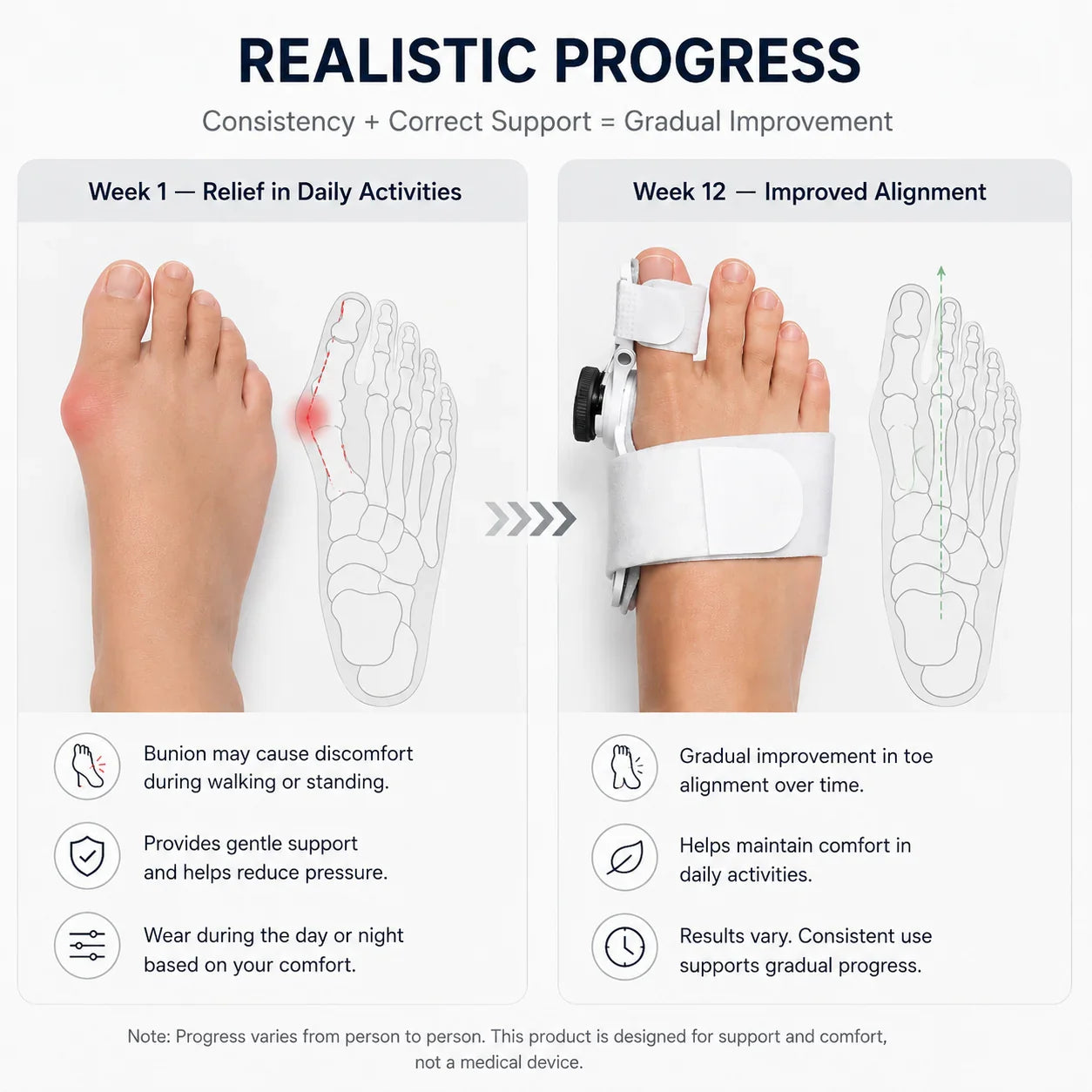 Bunion Corrector imported