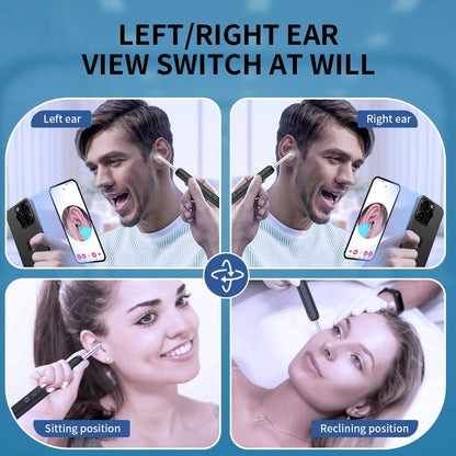 Ear Wax Cleaner with Camera — view 10 — EmartGCC Kuwait