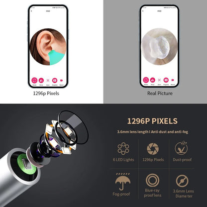 Ear Wax Cleaner with Camera — view 5 — EmartGCC Kuwait