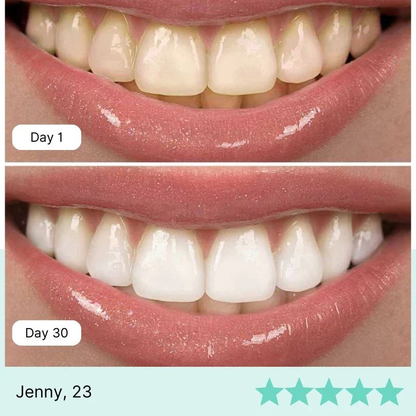 Teeth Whitening Water Flosser Imported