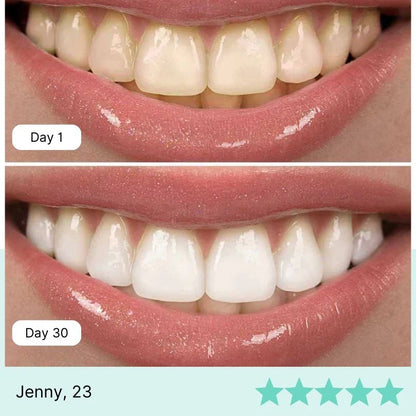 Teeth Whitening Water Flosser Imported